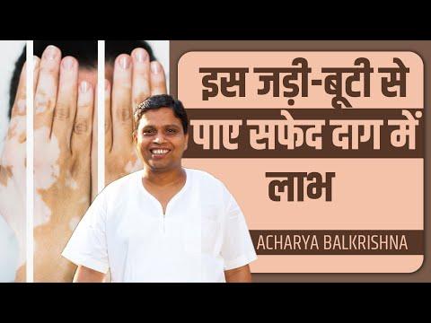 इस जड़ी-बूटी से पाए सफेद दाग (White Spots) में लाभ || Acharya Balkrishna