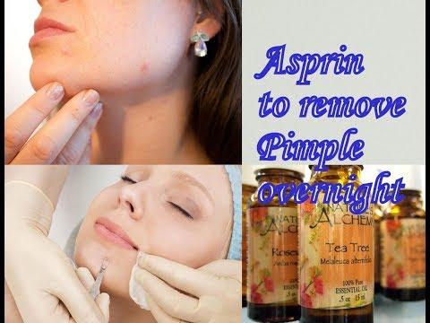 Remove Pimple overnight | Remove Pimple instantly with Aspirin | 100% Success | 3 Easy Steps