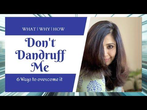 Dont Dandruff Me !