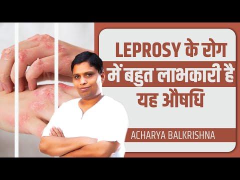 कुष्ठ (Leprosy) के रोग में बहुत लाभकारी है यह औषधि || Acharya Balkrishna