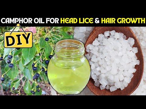 Dandruff Destroyer Camphor Oil is the SECRET to Healthy Scalp | Lice-Free Hair Naturally