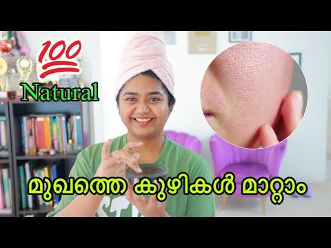 മുഖത്തെ കുഴികൾ മാറ്റാം എളുപ്പത്തിൽ_how to remove pores easily at home_simplymystyle Unni