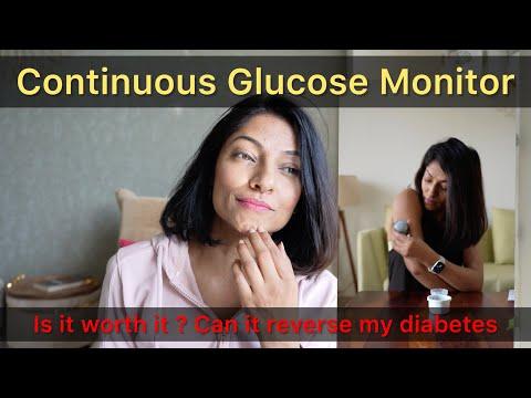 Don't Buy a Continuous Blood Sugar Monitor Until You See This!